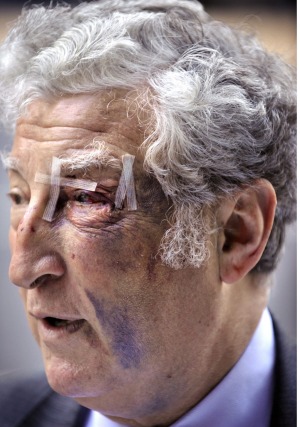 In 2009, ALex Lewenberg was viciously bashed by an intruder in his city apartment. Photo: Craig Abraham