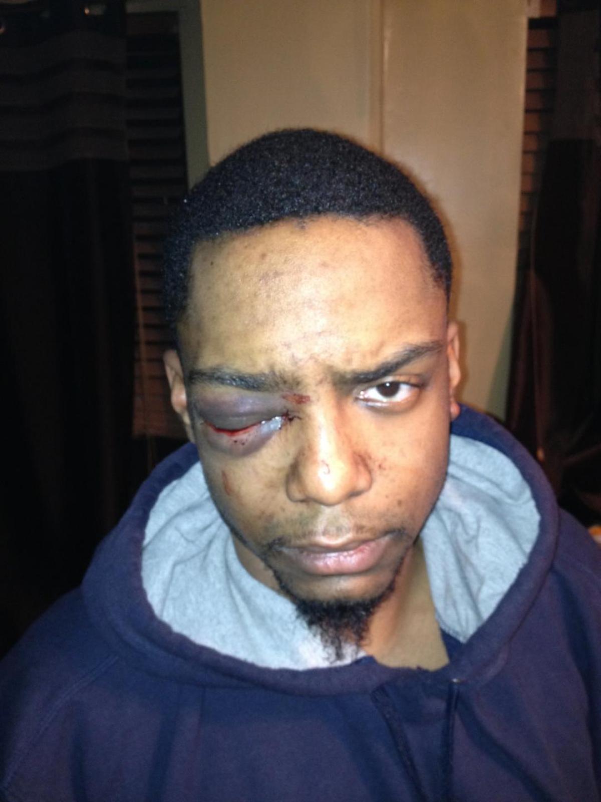 Taj Patterson was left permanently blind in the Dec. 2013 beating.