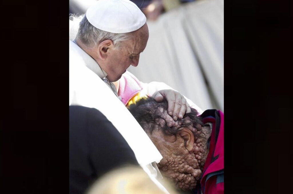Pope Francis embraces Vinicio Riva, 53, during his general audience in St. Peter’s Square at the Vatican Nov. 6, 2013. Riva, who is afflicted with neurofibromatosis, said receiving the pope’s embrace was like being in paradise. (CNS photo/Claudio Peri, EPA)
